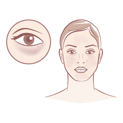 Dullness & Uneven Skin Tone
