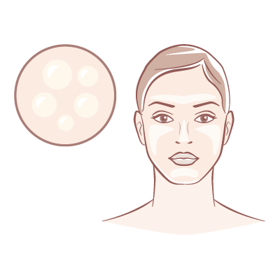 Excess Sebum & Shininess